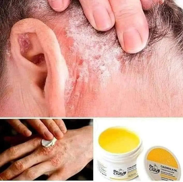 کرم بالسام آینه صفا ( کالندولا) فارماسی بسته بندی جدید