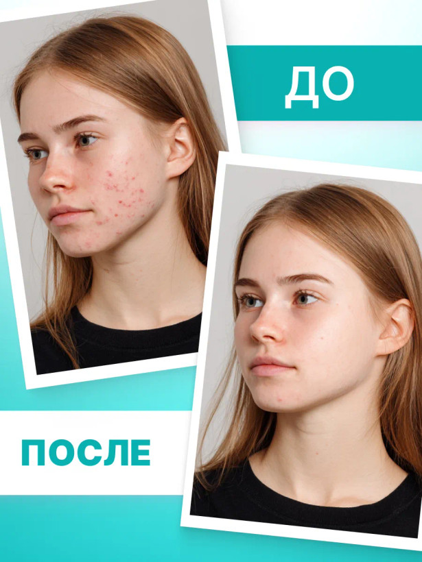 ژل پاک کننده عمیق تین اسکین فابرلیک روسیه مخصوص نوجوانان اورجینال